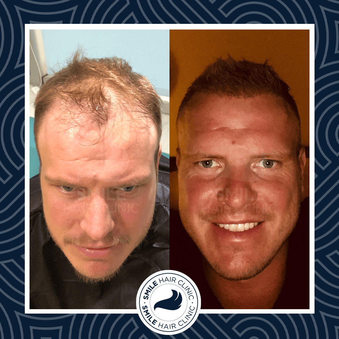 073 CHRISTIAN STEINHEIMER