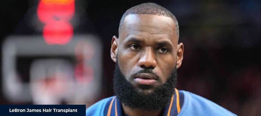 LeBron James Hair Transplant